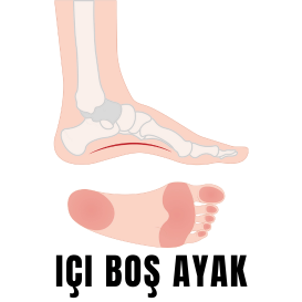 içi boş ayak
