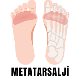 metatarsalji