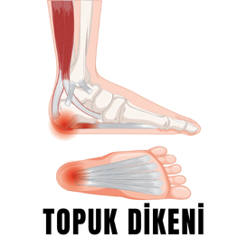 topuk dikeni